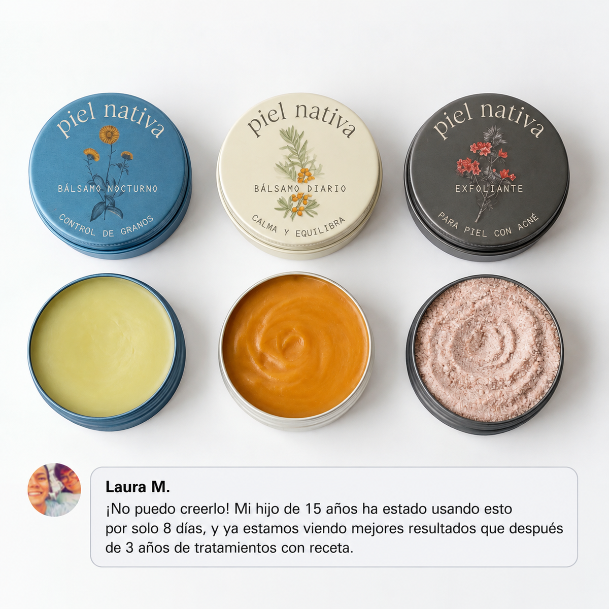 Piel Nativa — El sistema natural para piel con acné