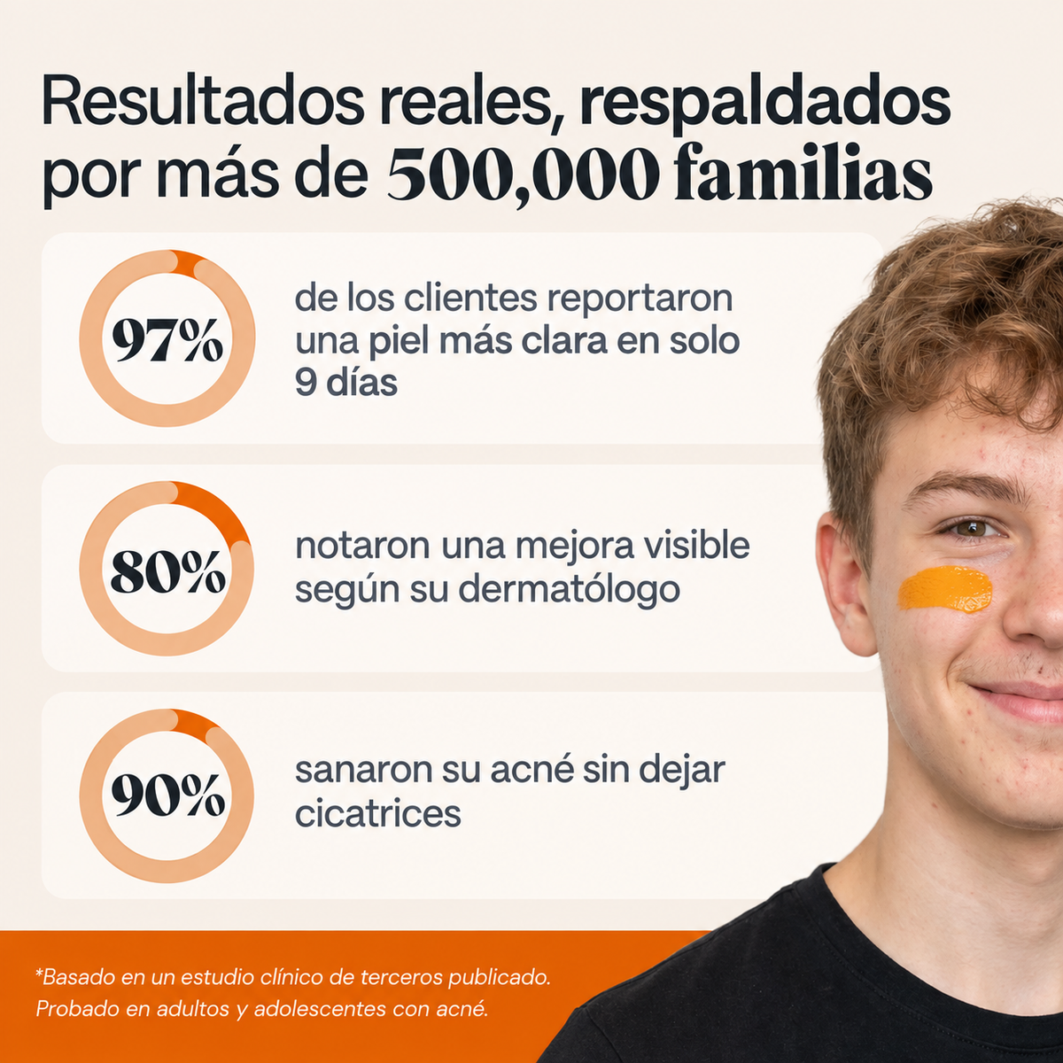 Piel Nativa — El sistema natural para piel con acné