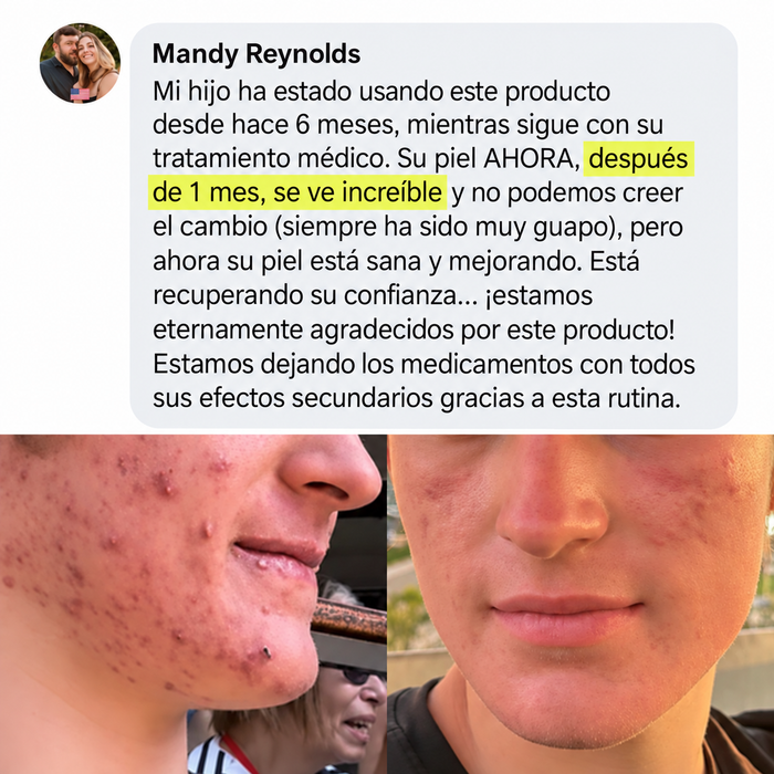 Caso de éxito 1